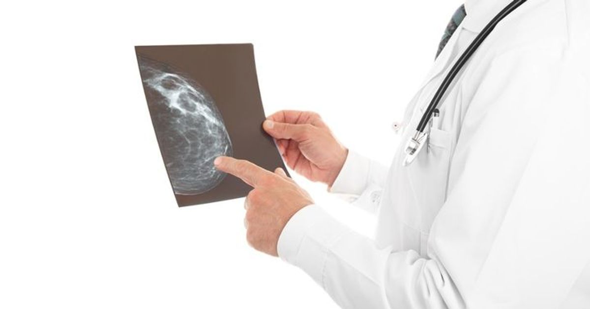 유방암, 20-30대도 안심 못한다...조기발견이 생존 '핵심' 집에서 하는 예방법 총정리 ( + 자가진단 방법 )