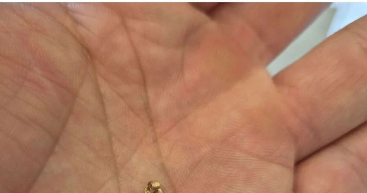 17년 만에 금을 발견한 디시인