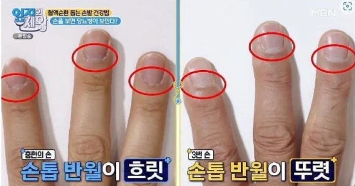 한의사 피셜 당뇨 진단법
