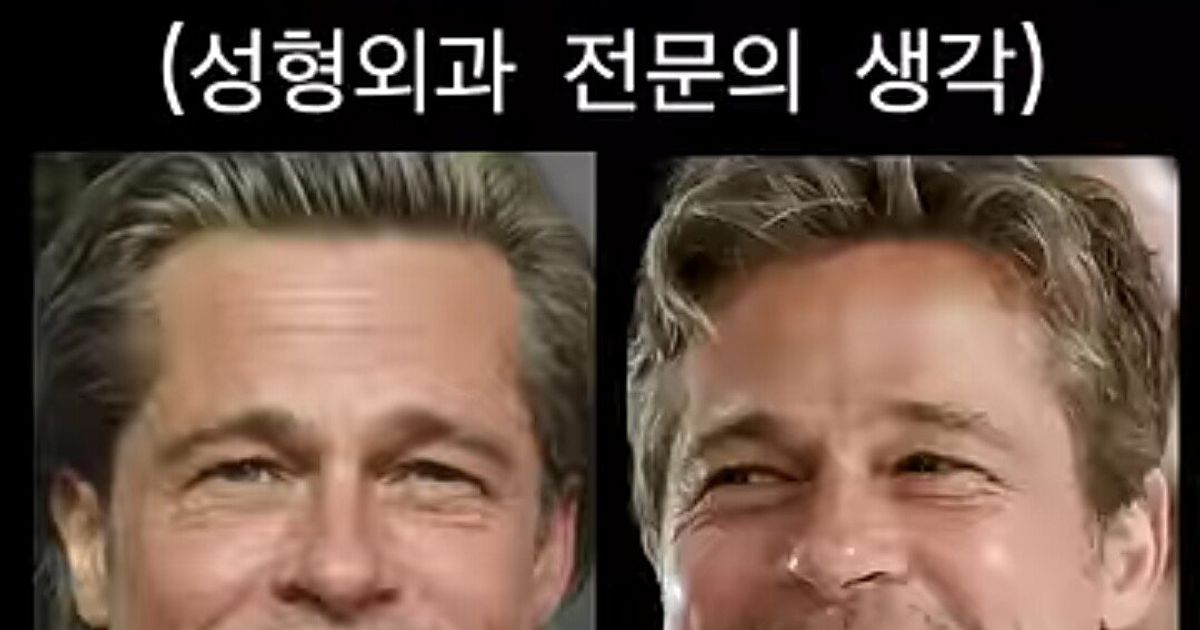 성형외과 의사도 극찬한 1억 6천짜리 성형
