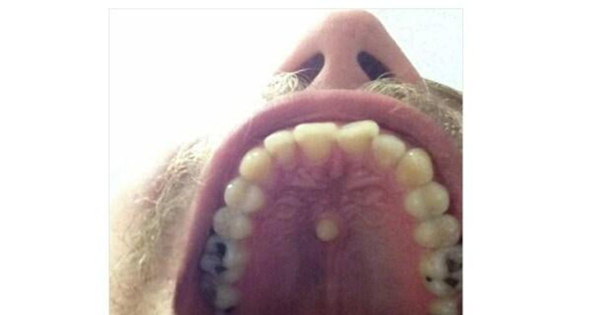 레전드 이빨 위치 jpg