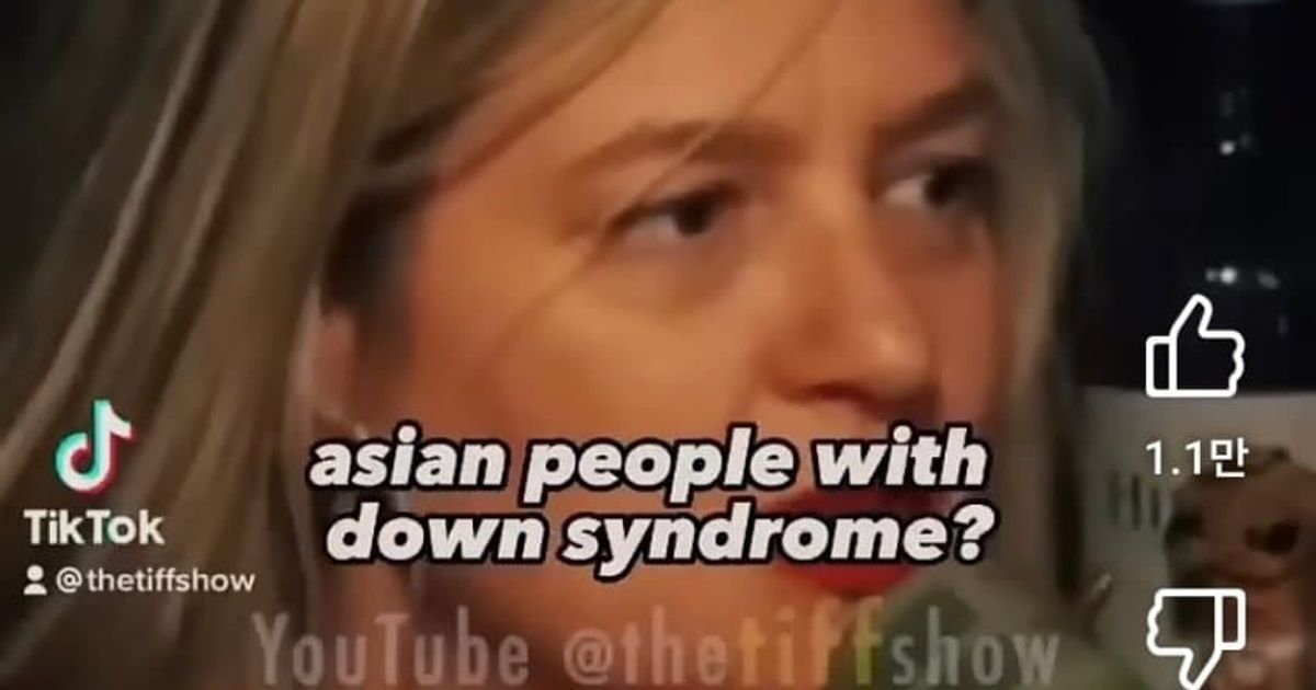 다운증후군이 있는 동양인을 찾기 힘든 이유 		,,